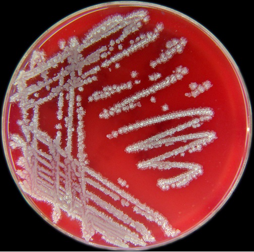 Bacillus licheniformis